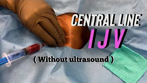 Central Line IJV (without ultrasound) | Central Venous Catheter | IV line
