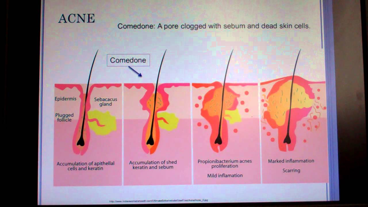 Dermatology part 1 YouTube