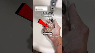 Os Calos Dele São Gigantes 🤯