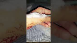 Sfx Makeup Tutorial .Hand burn effect makeup #creative #shorts #ytshorts #sfxmakeuptutorial