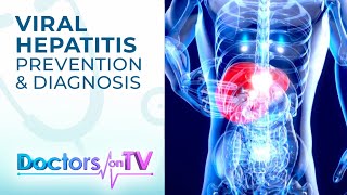 VIRAL HEPATITIS: Cause, Diagnosis, Prevention, and Treatment | DOTV