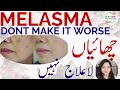 Melasma l dont make it worse l hyperpigmentation treatment l chaiyon ka ilaj