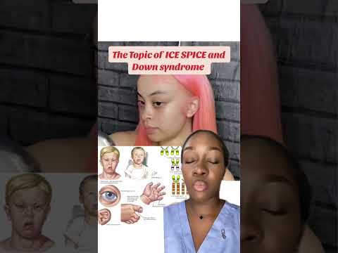 Fact Check: Does Ice Spice Have Down Syndrome or Is It an Internet Hoax?