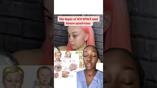 Does ice spice have actually have Down syndrome? Medical myths and mysteries Profile
