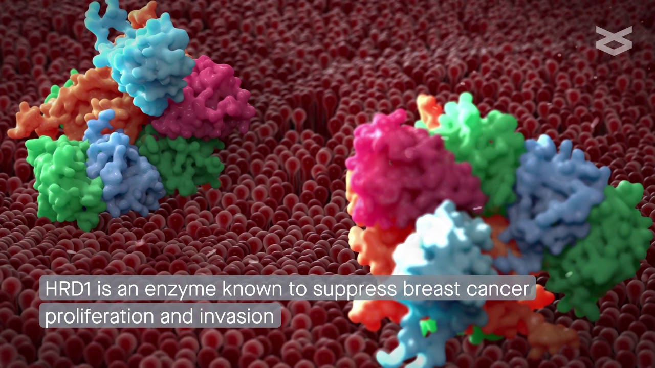 Key enzymes fuel growth and spread of breast cancer cells