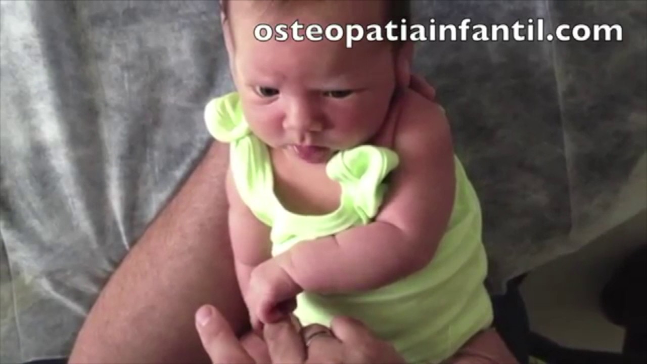 Bebé con Lesión del plexo braquial 3 y 4