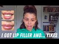 Why I got LIP INJECTIONS... and immediately got them REMOVED