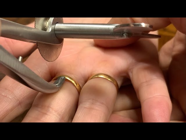 ANGRY FINGER Stuck Ring Removal Using The Ring Rescue Compression