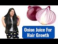 Onion juice to grow hair || Onion for Fast Hair Growth || Self Care Secrets