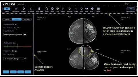 AI enbaled Computer aided diagnostics