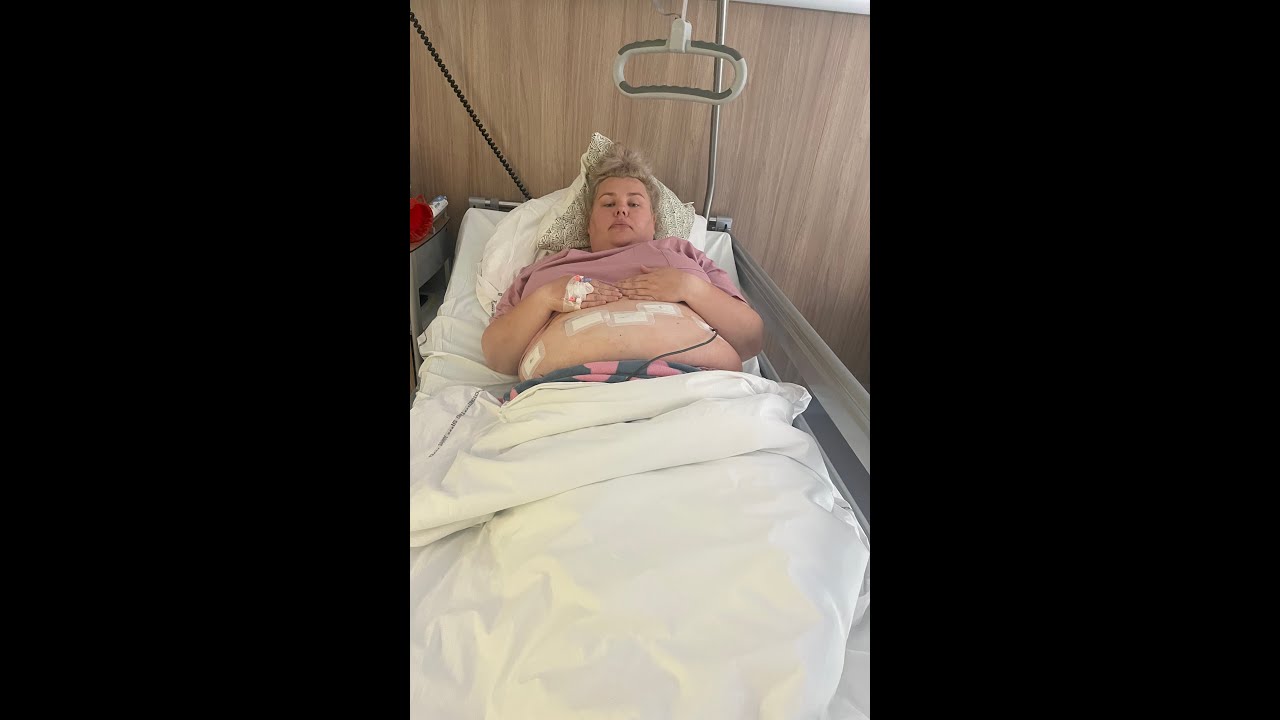 Operacja bariatryczna | ZMNIEJSZENIE ŻOŁĄDKA | przygotowanie