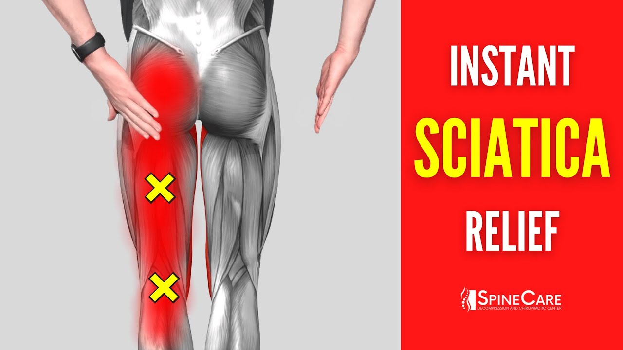 7 Tips for Fast Sciatic Pain Relief  Midwest Orthopedic Specialty Hospital