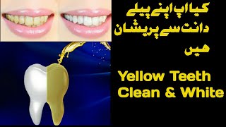 How To Whiten Teeth Urdu Hindi | Peele Dant Saaf Kese kare | Antibacterial Agent to White your teeth