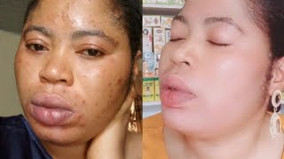 كيف أزيل البقع الداكنة في 7 أيام / كريم ميلانو فري / أولايباكت BSC #darkspot #skincare