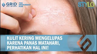 Kulit Mengelupas Akibat Panas Matahari, Segera Hindari 3 Hal Ini!