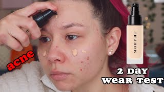 2 DAY WEAR TEST on ACNE | Morphe Filter Effect Foundation