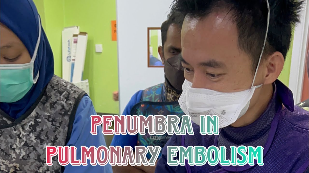 Steps for using Penumbra In Pulmonary Embolism YouTube