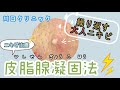 繰り返すニキビにお悩みの方へ【ニキビ治療／皮脂腺凝固法】