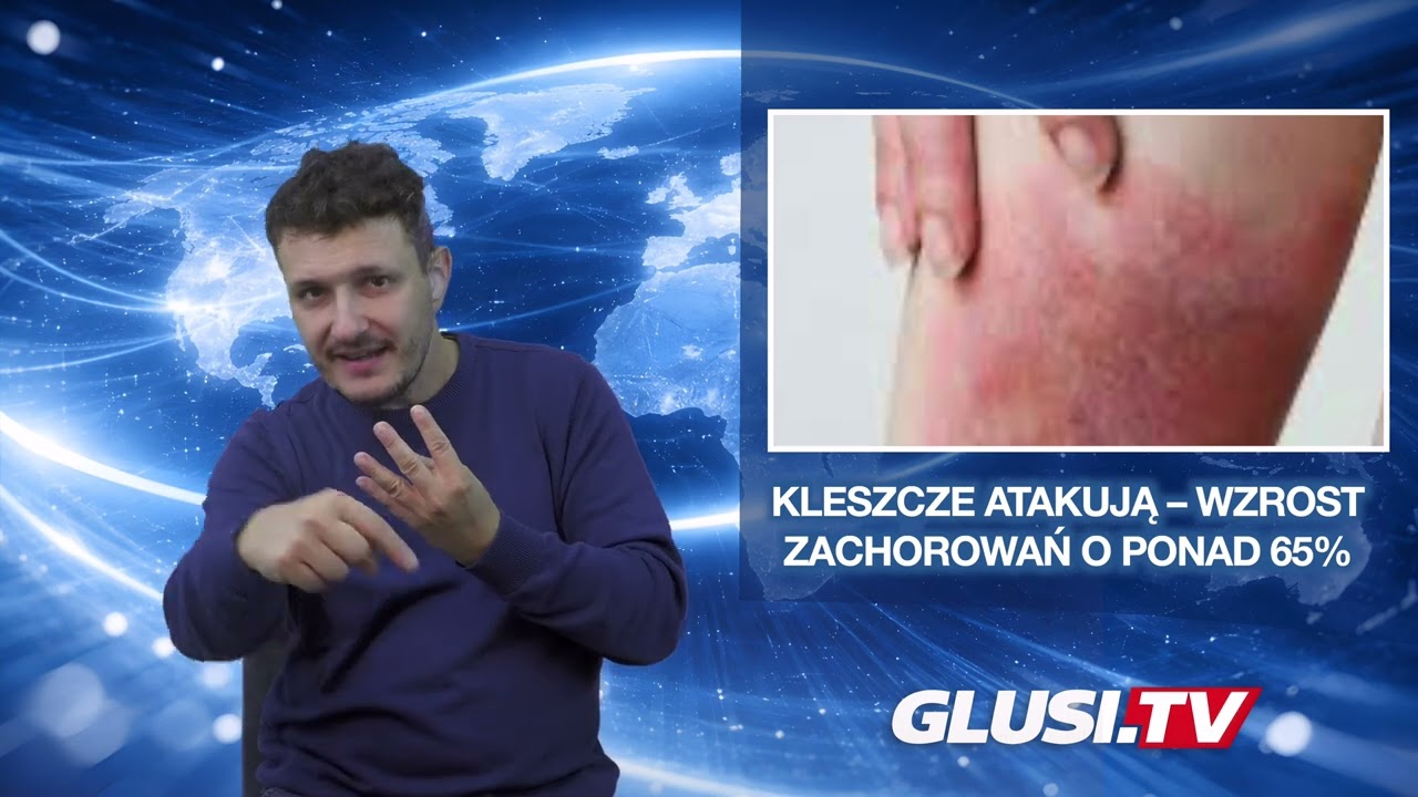 Kleszcze atakują – wzrost zachorowań o ponad 65%
