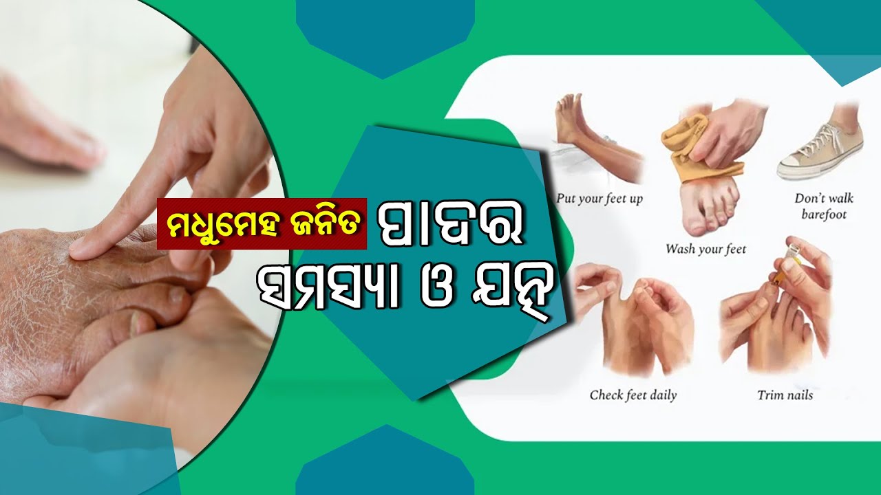 Health Show - Live   || Dibetic Foot Care ||  23rd July,  2025  @ 6.30 PM
