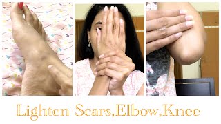 Bridal Series:Lighten Dark elbow,knees,Feet & get Glass Skin Bridal Series:Lighten Dark elbow,knees,Feet & get Glass Skin
