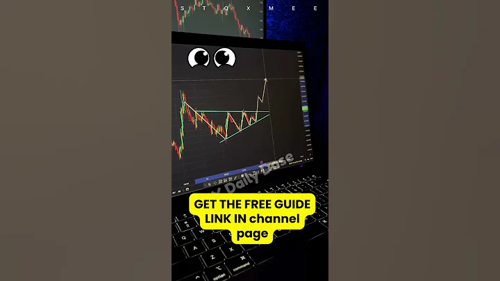 How To Analysis Pattern in 30sec #trading #forex #daytrading #forexstrategy