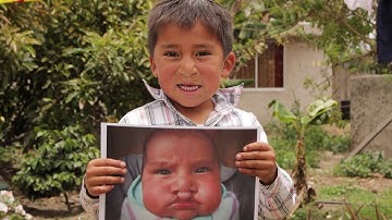 The Importance of Cleft Orthodontics