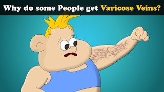 Why do some People get Varicose Veins? + more videos | #aumsum #kids #science #education #children