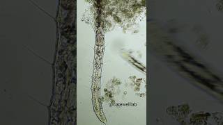 Oligochaeta naididie | CareWell Laboratory | #shorts #short #parasite