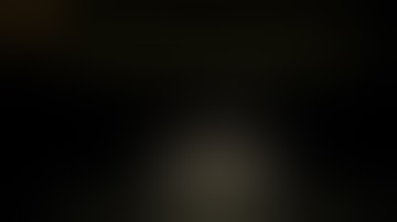 LAP LYMPHADENECTOMY FOR RIGHT COLON CANCER