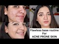 Base makeup routine for acne scars/ acne prone skin | tips & tricks for full coverage