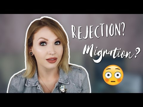 Is Your Piercing REJECTING? Or MIGRATING?