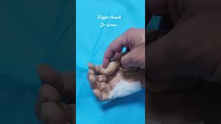 Trigger thumb.. Dr wisam Abuzaid