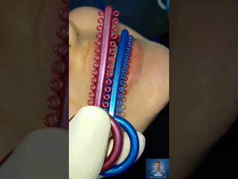 روعة اختيار اللون لاساتك التقويم 