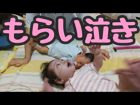 【もらい泣き】次の手術に向けて療養中15 (第２子に反応・・・)