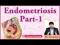 44 endometriosis  part 1