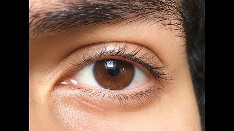 My Eye Color Changing Journey from Brown To Hazel Green (HONEST VIDEO)