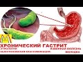 ХРОНИЧЕСКИЙ ГАСТРИТ и ЯЗВА ЖЕЛУДКА. Этиология. Классификация