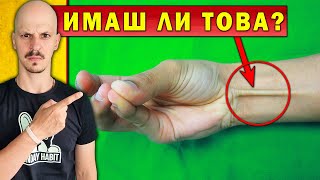 ТОП 10 АНОМАЛИИ НА ТЯЛОТО, които ТЕ ПРАВЯТ СУПЕР РЯДЪК