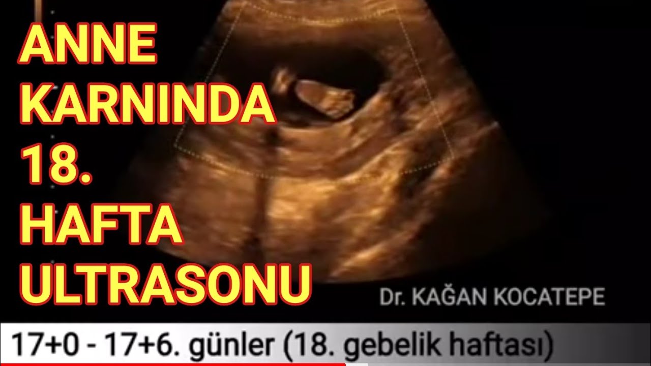 18 gebelik haftasinda anne karnindaki bebege ait ultrasonografi goruntuleri youtube