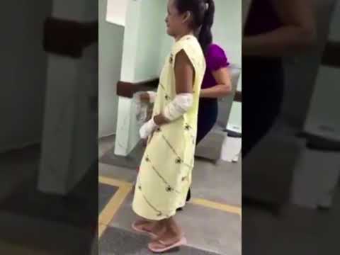 Mulher esf4.qu3ada pelo ex-companheiro volta a andar