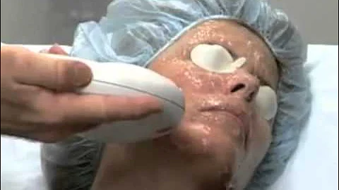 IPL Photofacial Treatment | Cosmetic Laser Dermatology