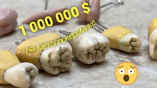 Ответы на вопросы зубнику. 1 000 000 $  на металлокерамике  😂  .   Зубной техник