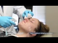 Learn about Chemical Peels - Forefront Dermatology