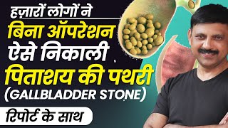 बिना ऑपरेशन Gallbladder Stone (पित्ताशय की पथरी) का अचूक इलाज | Manas Samarth