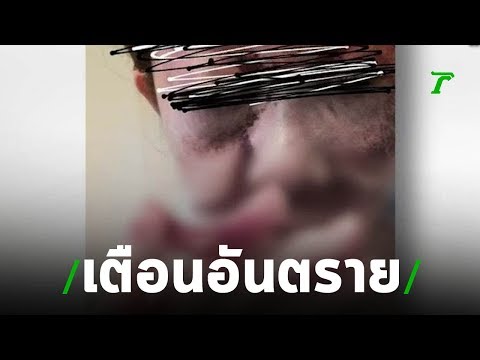 สาวโพสต์เตือนเที่ยวญี่ปุ่นลำพังอันตราย | 08-08-62 | ข่าวเช้าไทยรัฐ