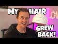 MY HAIR GREW BACK! 6 months using iRestore! Laser Hair Growth Therapy