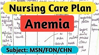 Nursing Care Plan on Anemia/ NURSING Process, Nursing Diagnosis @nursingcriteria