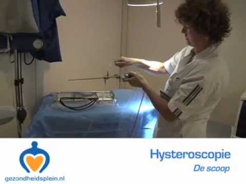 Video: Hysteroscopische Verwijdering Van Endometriumpoliepen