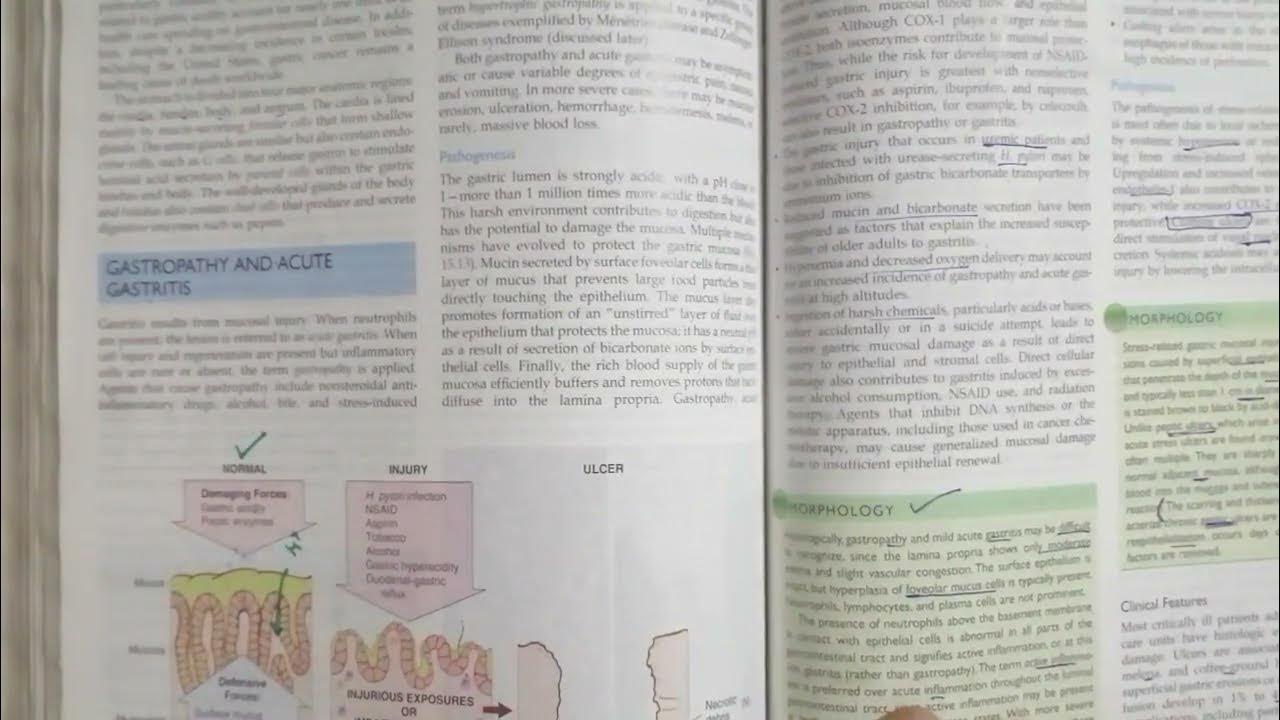 stress-related-mucosal-ulcers-in-urdu-hindi-lecture-3-youtube